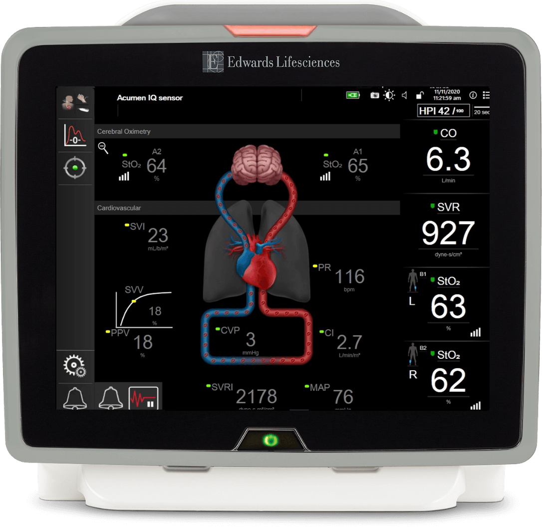 HemoSphere�erweiterte��berwachungsplattform